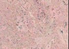 Herse Creme